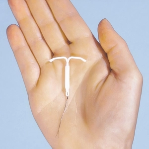 بعد از گذاشتن ای یو دی باید استراحت کرد؟