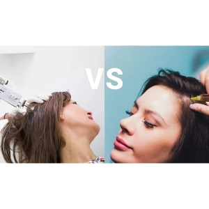 پی آر پی صورت بهتر است یا مزوتراپی صورت؟