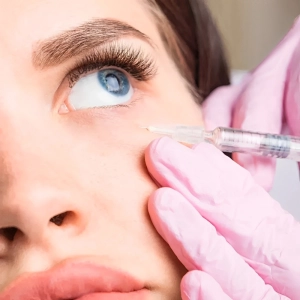 پف زیر چشم‌تان را برای همیشه فراموش کنید: کوکتل مزوتراپی، راه حل نهایی!