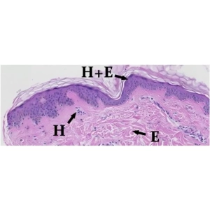 رنگ‌آمیزی هماتوکسیلین-ائوزین چیست؟