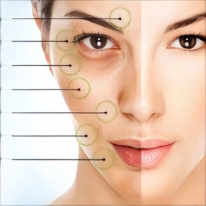 هایفوتراپی چیست