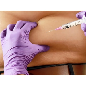 لاغری موضعی با مزوتراپی: خداحافظی با چربی‌های صورت و بدن