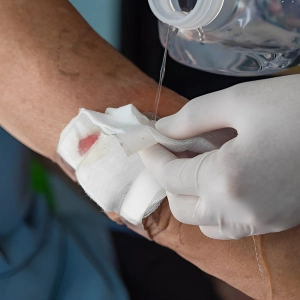 چگونه گاز استریل چسبیده به زخم را جدا کنیم