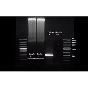 تفسیر باندهای الکتروفورز