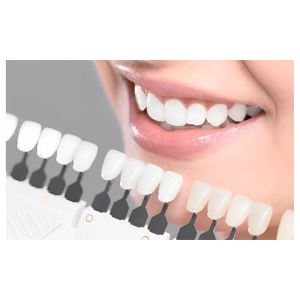 کامپوزیت زنیت بهتره یا سارمکو