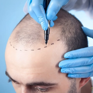 روش های درمانی برای رشد مو