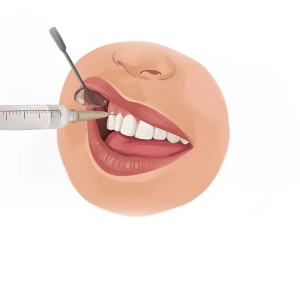 بهترین بی حس کننده دندان