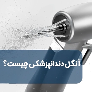 آنگل دندانپزشکی چیست