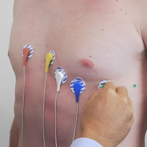 نحوه اتصال چست لید مانیتورینگ