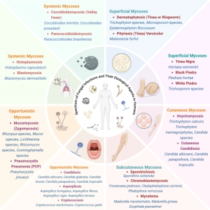 انواع عفونت‌های قارچی (Mycoses)