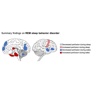 رابطه مغز با خواب