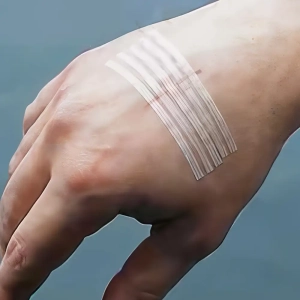 چسب بخیه چیست