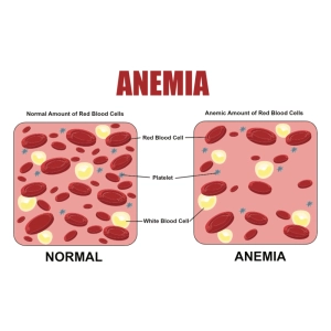 آنمی و اختلالات خونی شایع