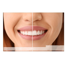 کامپوزیت توکویاما یا کاریزما