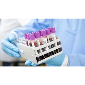 تکنیک‌های آزمایشگاهی در تشخیص بیماری‌های خون