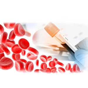 پی آر پی رحم چیست و چگونه انجام می‌شود؟