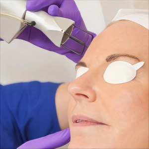 لیزر فرکشنال