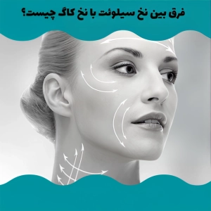 نخ کاگ بهتره یا سیلوئت