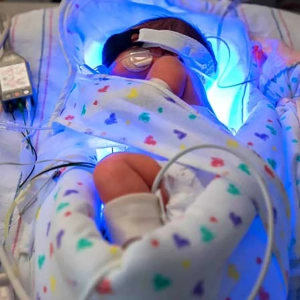 تغذیه مادر در ماه های اخر بارداری و تاثیرات آن بر زردی نوزاد و سطح بیلی روبین توتال سرمی نوزاد