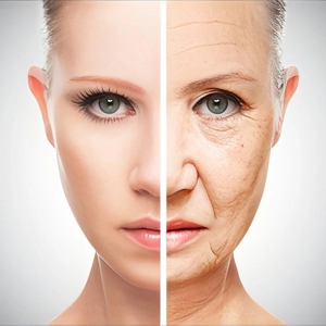 لیفت صورت با نخ برای چه سنی مناسب است