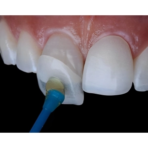 کامپوزیت نانو سرامیک چیست