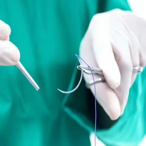 نحوه کشیدن بخیه