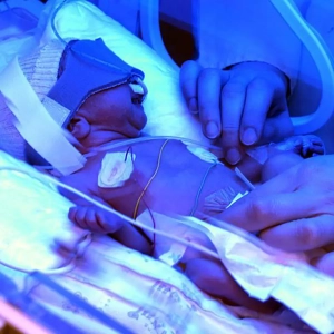 زردی نوزاد چقدر طول می‌کشد ؟ و علل اصلی بروز آن در نوزادان