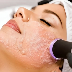 پلاژن تراپی صورت برای لک