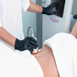 لیزر لیپولیز