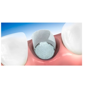 مدت زمان جوش خوردن پودر استخوان