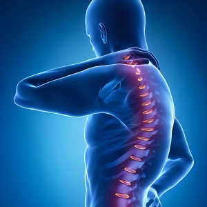 بهترین قوزبند طبی رفع افتادگی شانه