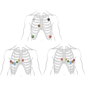 محل نصب چست لید