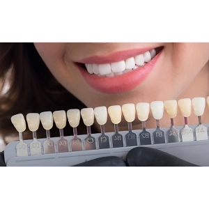 بهترین رنگ برای کامپوزیت دندان