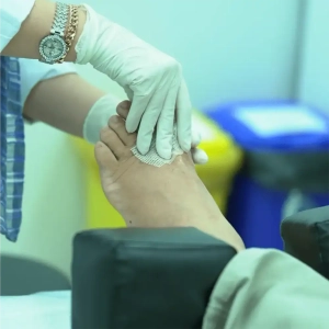 پانسمان نقره برای زخم پای دیابتی