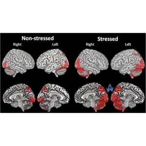 اثر استرس بر مغز