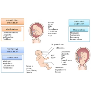 مادرزادی و مکانیسم‌های ایجاد آن‌ها