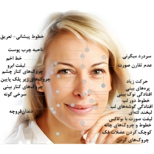 بوتاکس چیست