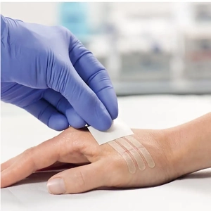 چسب بخیه چند روز باید بماند