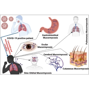 درمان خانگی و دارویی عفونت قارچی