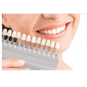 رنگ بندی کامپوزیت توکویاما