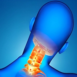 بستن گردنبند طبی برای دیسک گردن