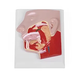 مولاژ غدد بزاقی