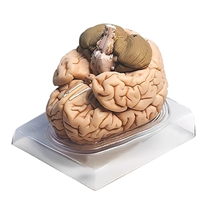 مولاژ مغز انسان