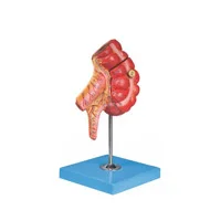 مولاژ آپاندیس