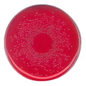 محیط کشت برلیانت گرین فنول رد لاکتوز ساکارز آگار BPLS