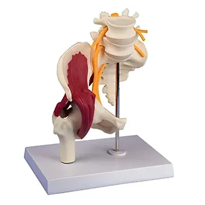 مولاژ آناتومی لگن زن با ماهیچه و عصب سیاتیک