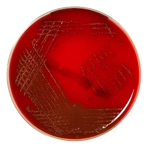 محیط کشت کمبود سیستین لاکتوز الکترولیت آگار