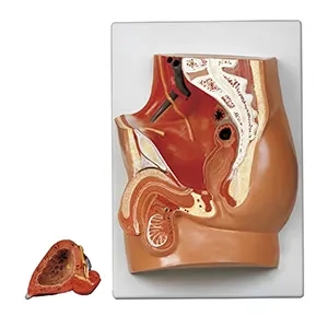 مولاژ لگن خاصره مرد