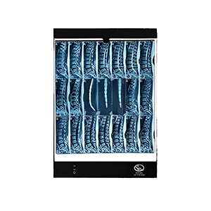 نگاتوسکوپ SM300