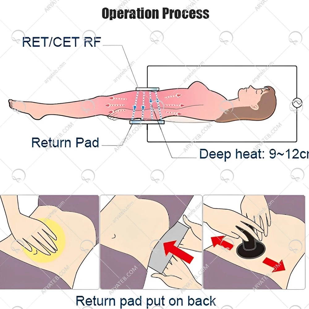 دستگاه لاغری تکار RF 2024